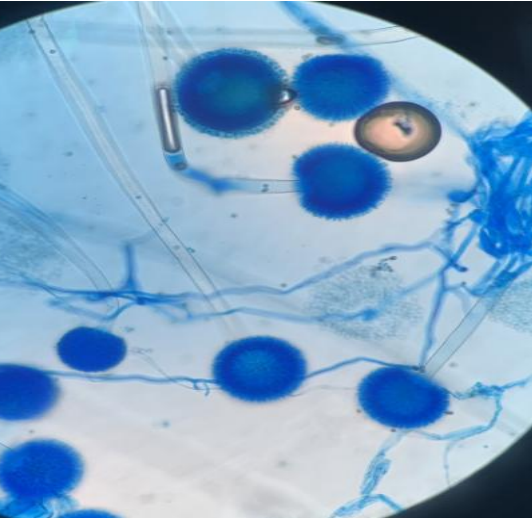 生物气溶胶
